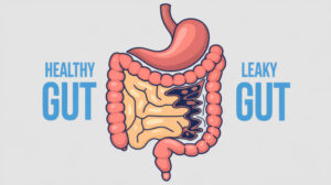 Gut health: Leaky gut vs a healthy gut diagram
